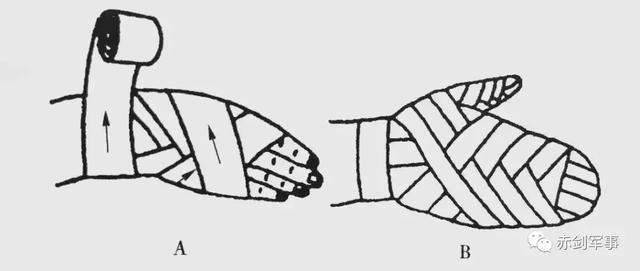 手臂绷带八字包扎法
