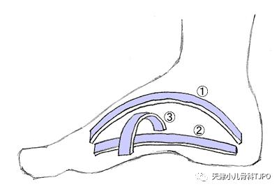 儿童肘关节八字症治疗