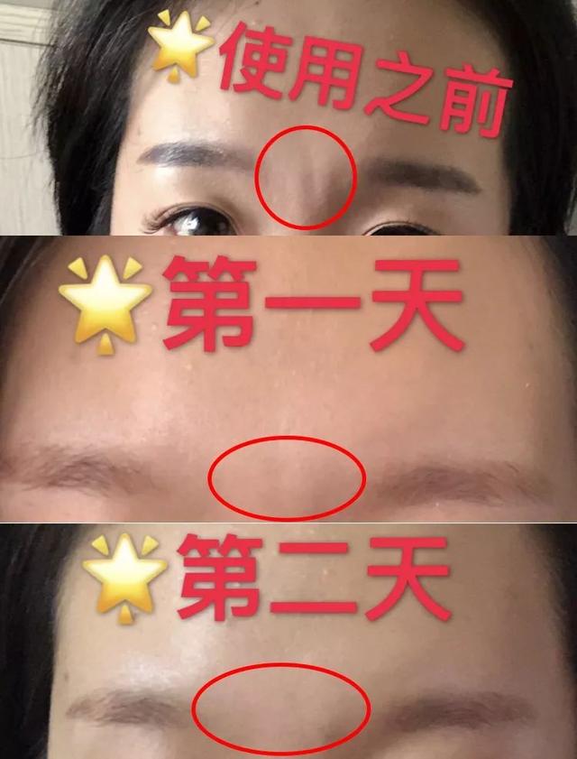 如何获取除眉间八字纹