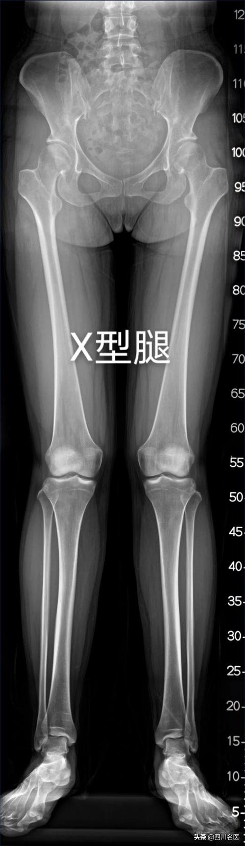 怎么知道自己是不是走八字路