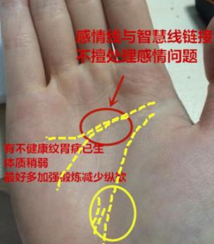 纵欲导致眼睛下八字纹