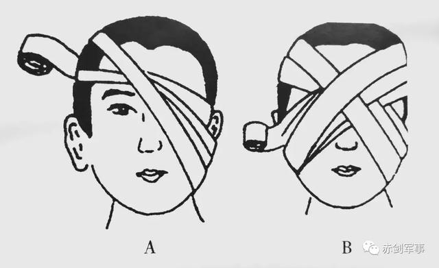 绷带枕部八字法图片