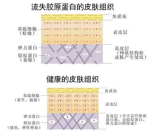 眼睛下方凹陷八字斜线