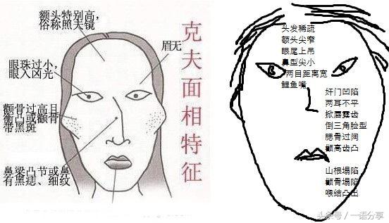 眉中间有个八字形