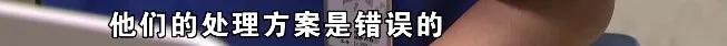 医疗八字绷带固定方法