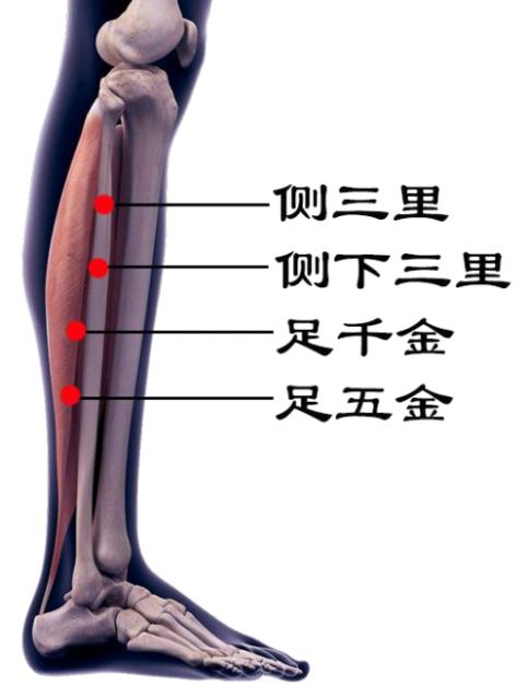 八字针灸网球肘