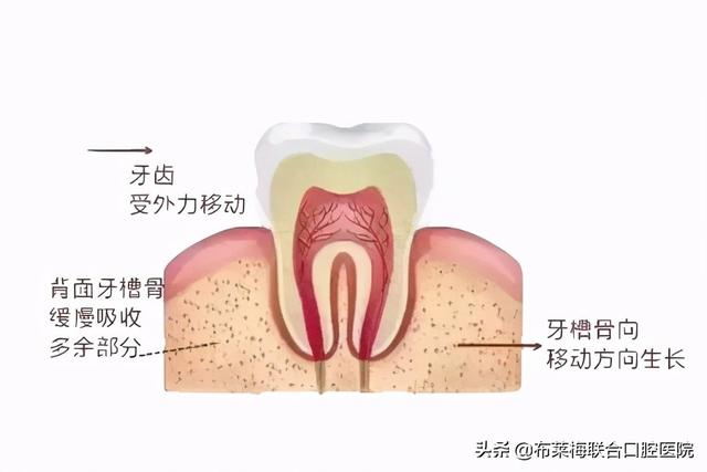 尖牙和后牙八字结扎